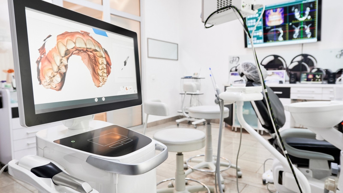 Koje su prednosti digitalnog zubnog otiska?