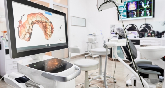 Koje su prednosti digitalnog zubnog otiska?