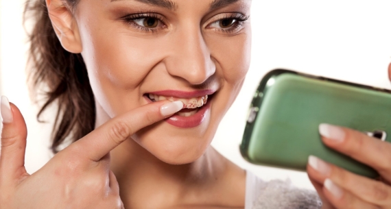 Kako nastaju i kako se mogu ukloniti mrlje na zubima?
