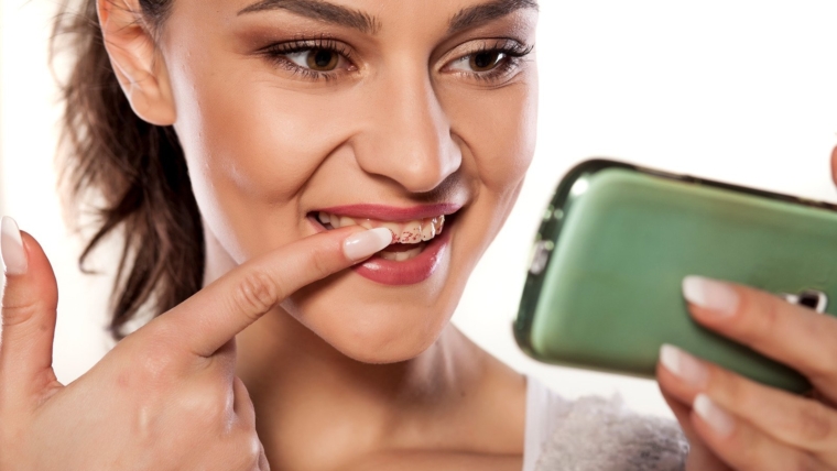 Kako nastaju i kako se mogu ukloniti mrlje na zubima?